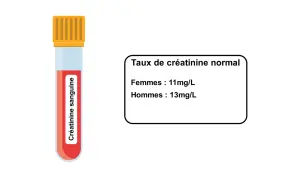 Tube de sang pour analyse de créatinine. Le taux normal est de 11mg/L pour les femmes et 13mg/L pour les hommes, indiquant qu'une créatinine urinaire élevée peut signaler un problème.