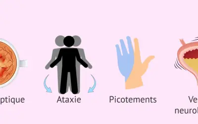 Symptômes de la sclérose en plaques : névrite optique, ataxie, picotements et vessie neurologique.