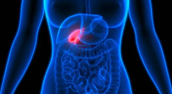Anatomie humaine, vésicule biliaire rouge vif, suggérant une douleur au foie et au dos.