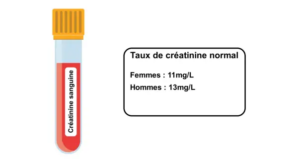 Tube de sang pour analyse de créatinine. Le taux normal est de 11mg/L pour les femmes et 13mg/L pour les hommes, indiquant qu'une créatinine urinaire élevée peut signaler un problème.