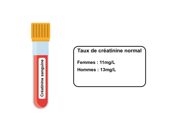 Tube de sang pour analyse de créatinine. Le taux normal est de 11mg/L pour les femmes et 13mg/L pour les hommes, indiquant qu'une créatinine urinaire élevée peut signaler un problème.